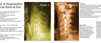 Chiropractic posters and charts