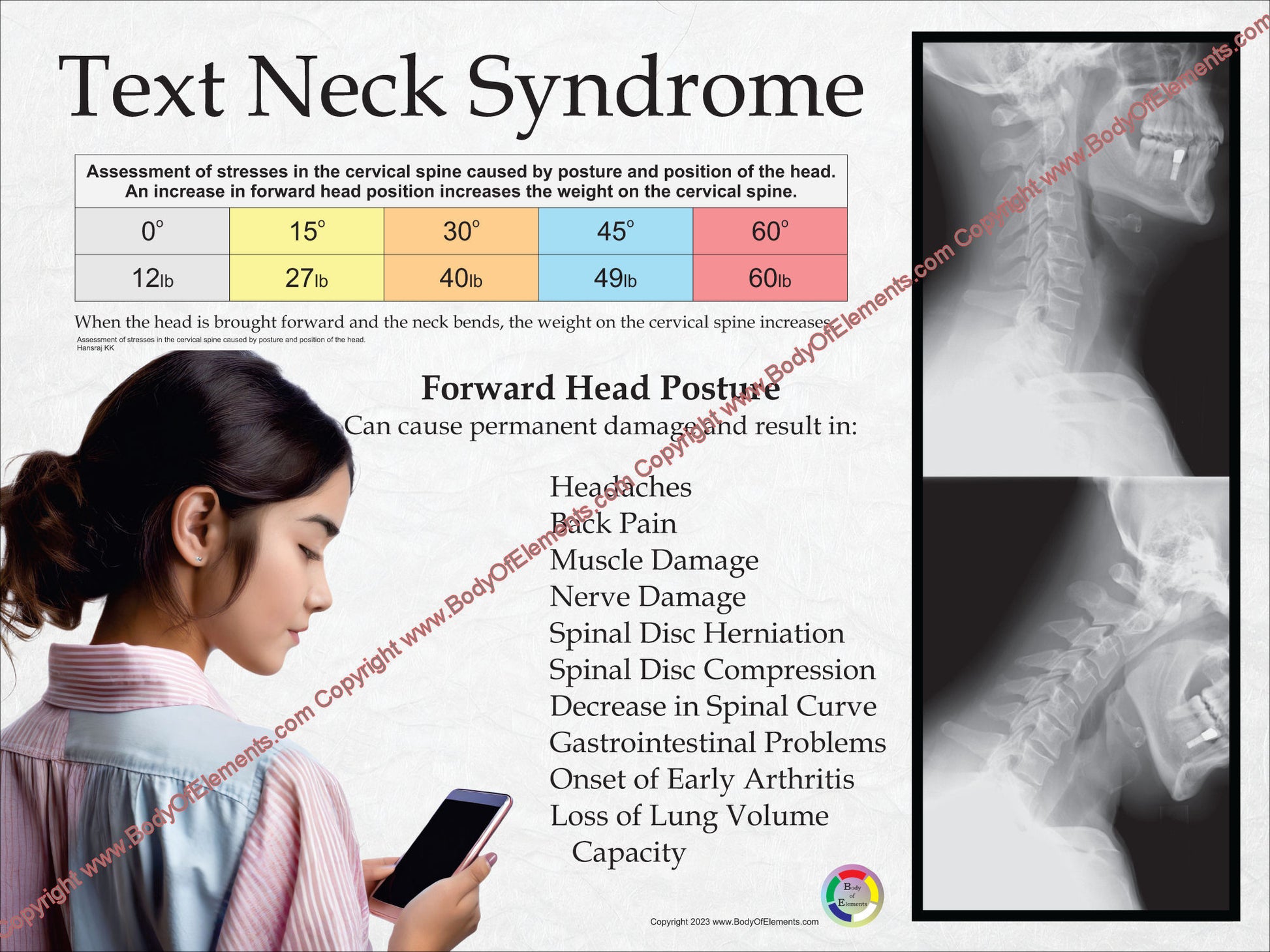 Young girl neck pain texting chart.