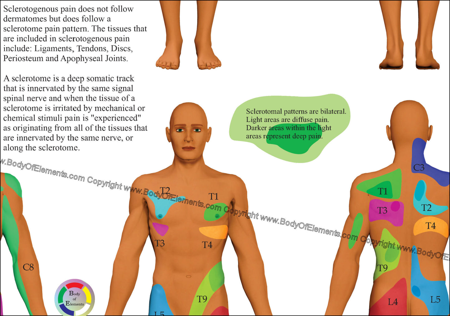 Sclerotome Visceral Pain Referral Poster