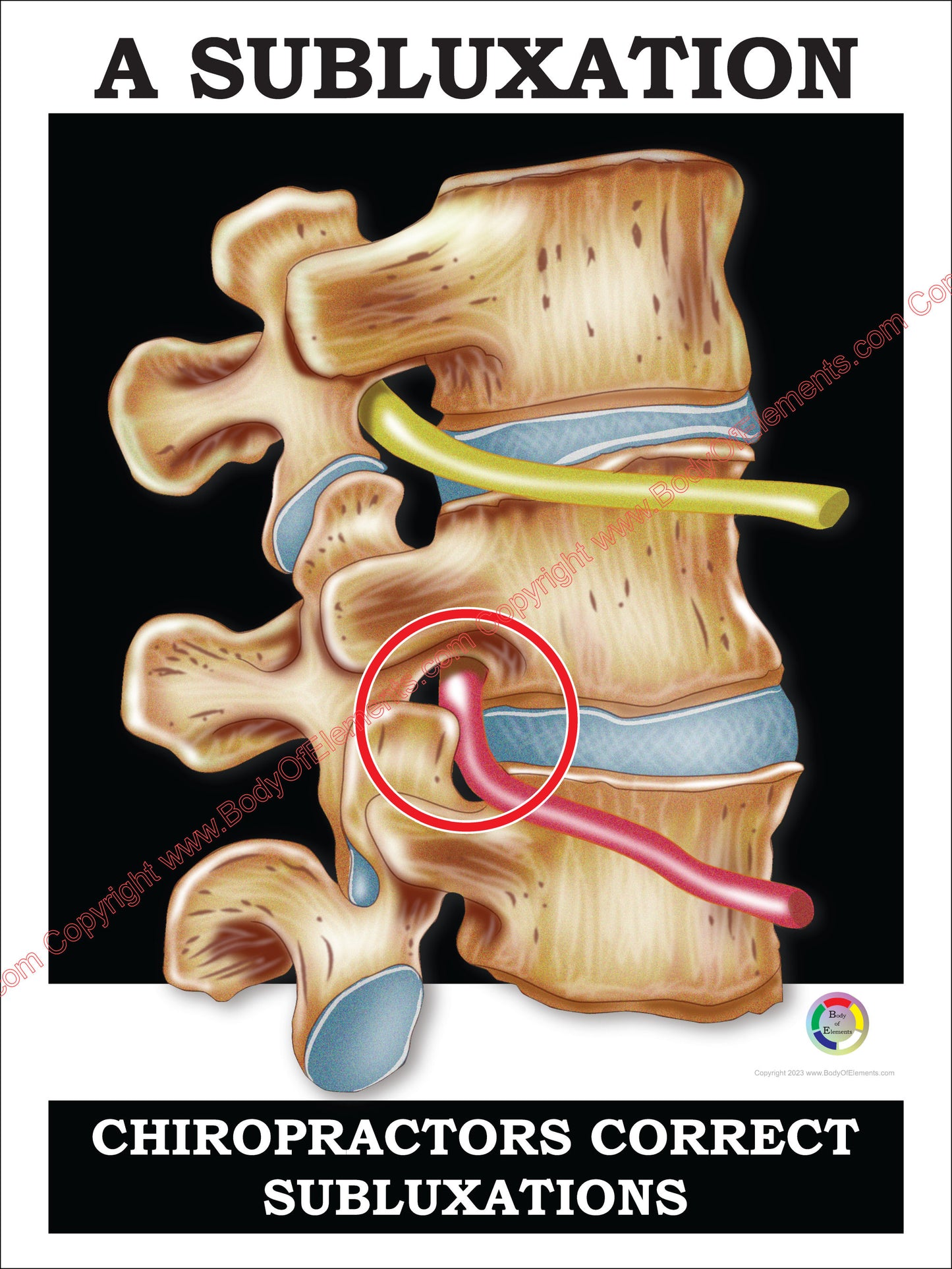 Chiropractors correct subluxations poster