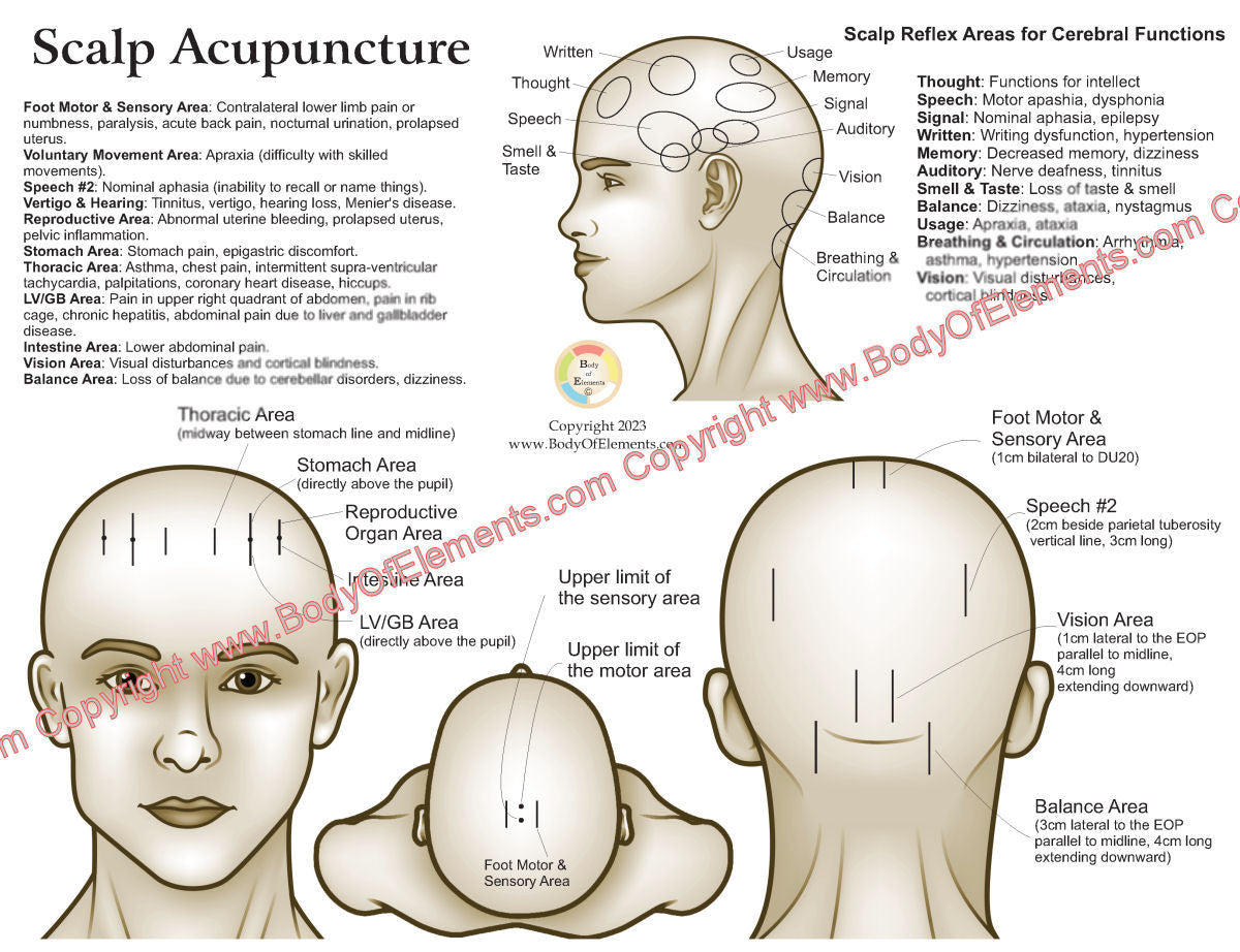 Scalp acupuncture chart