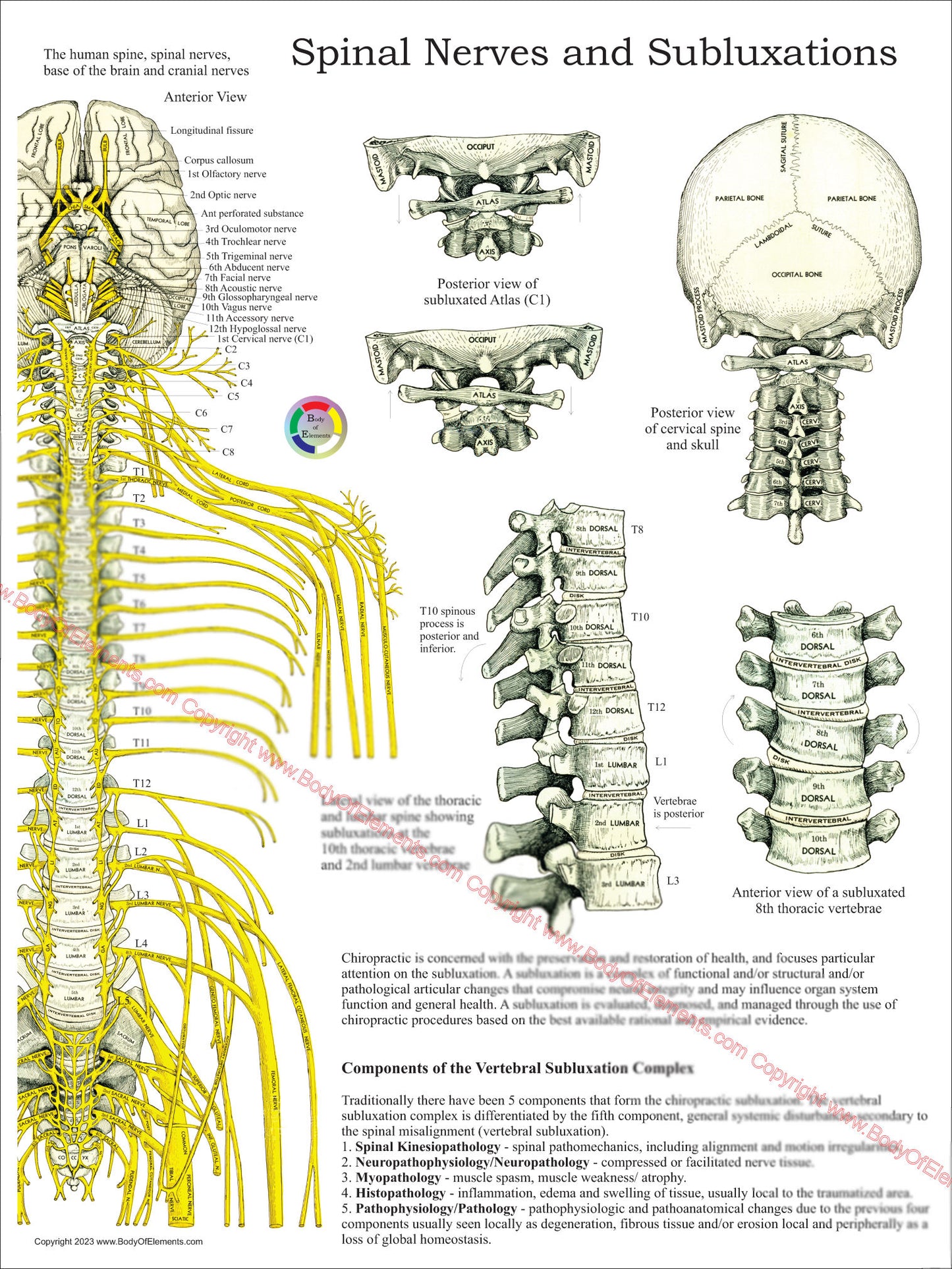 Vertebral Subluxation Complex Chart