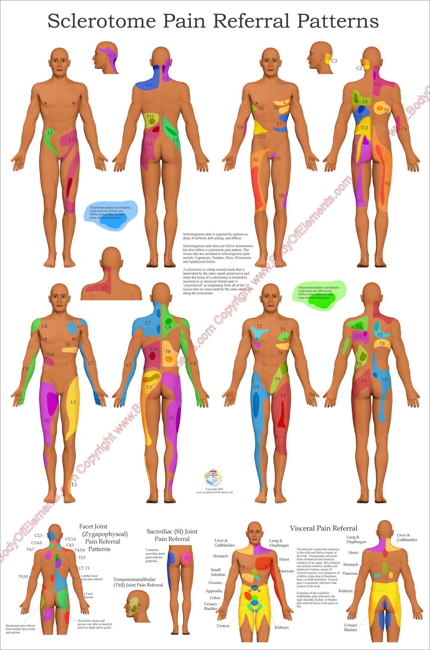 Sclerotome Visceral Pain Referral Poster