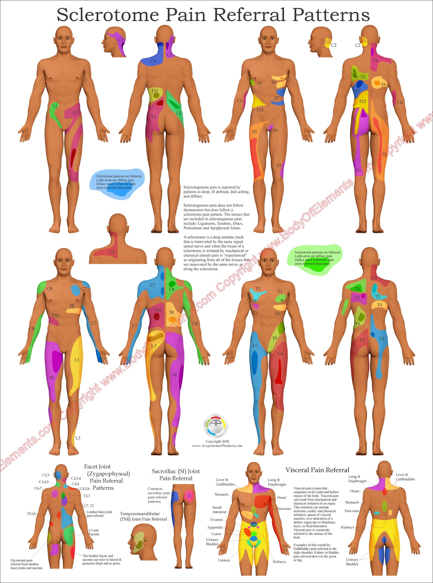 Sclerotome Visceral Pain Referral Poster