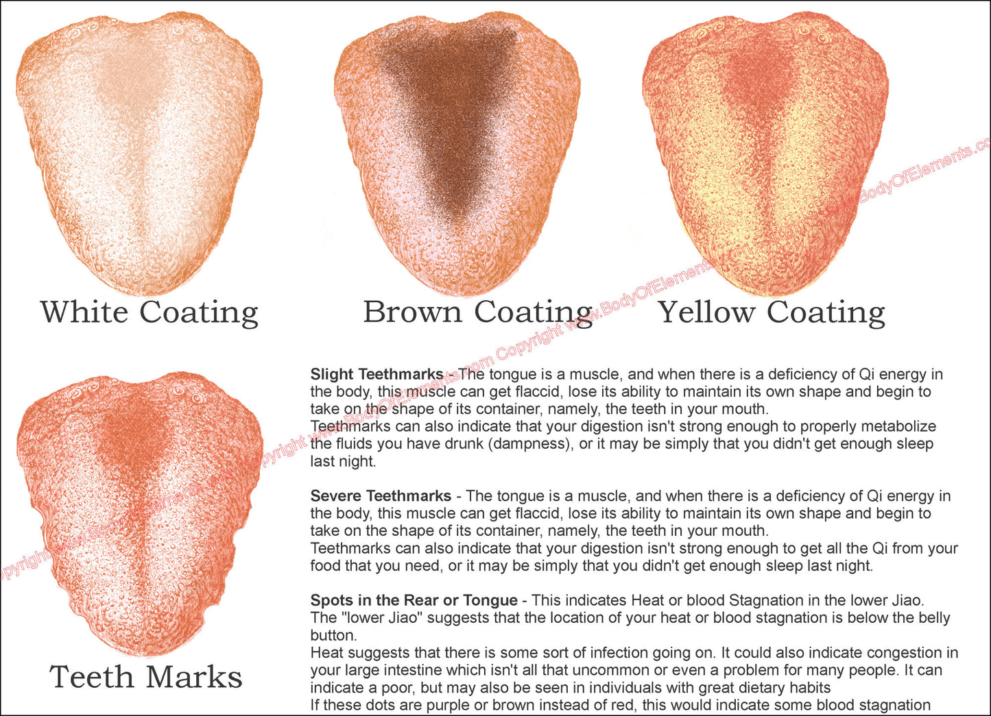 Tongue diagnosis coating descriptions