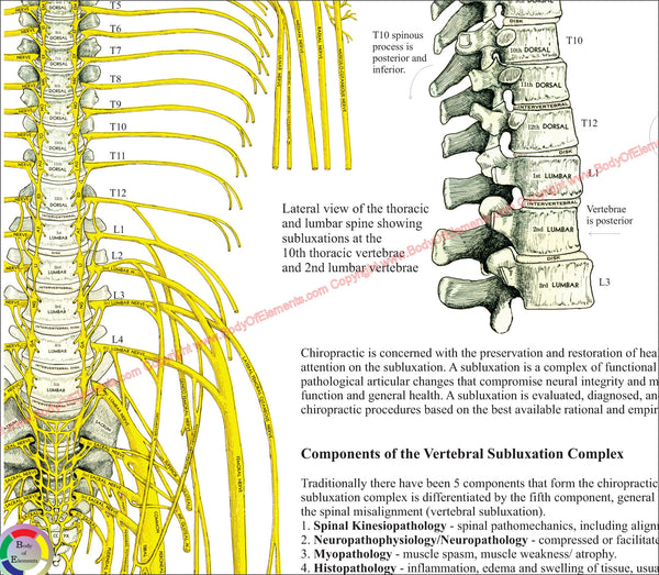 Chiropractic Subluxation Complex Poster – Body of Elements