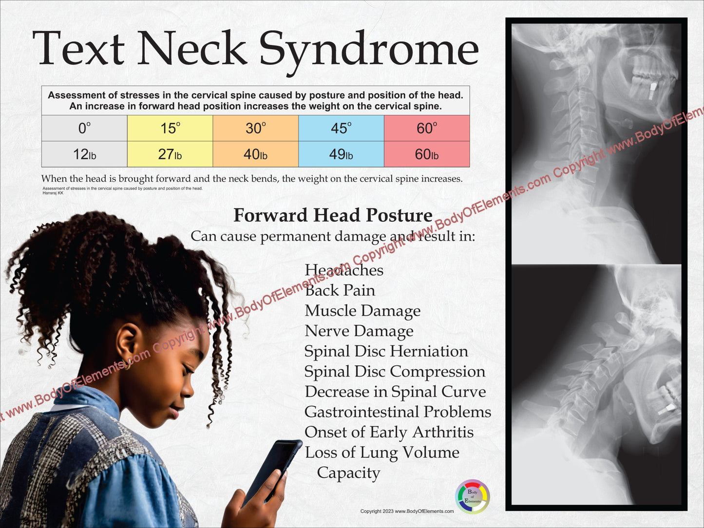 Text neck poster young girl on cellphone.