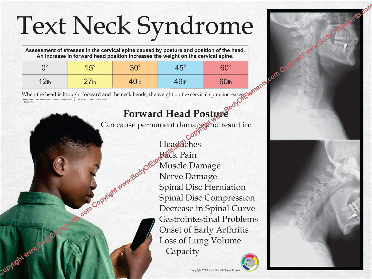 Children headaches texting neck pain poster.