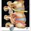 Chiropractors correct subluxations poster