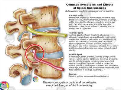 Common Effects of Spinal Subluxation Poster