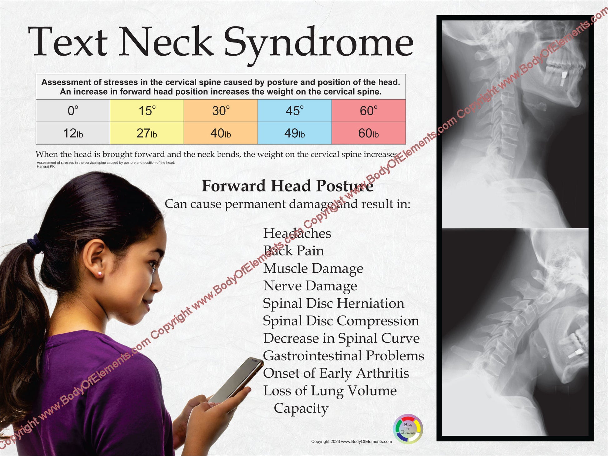 Pain from forward head position texting poster.