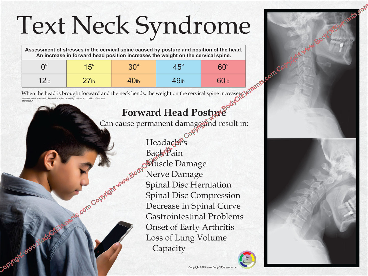 Forward head position pain children texting poster.