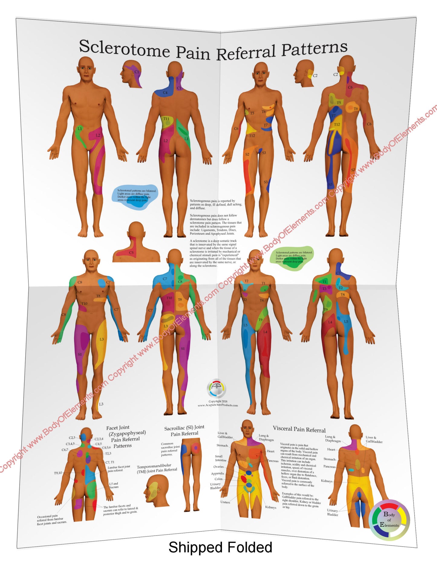 Sclerotomes Visceral Pain Referral Poster Folded