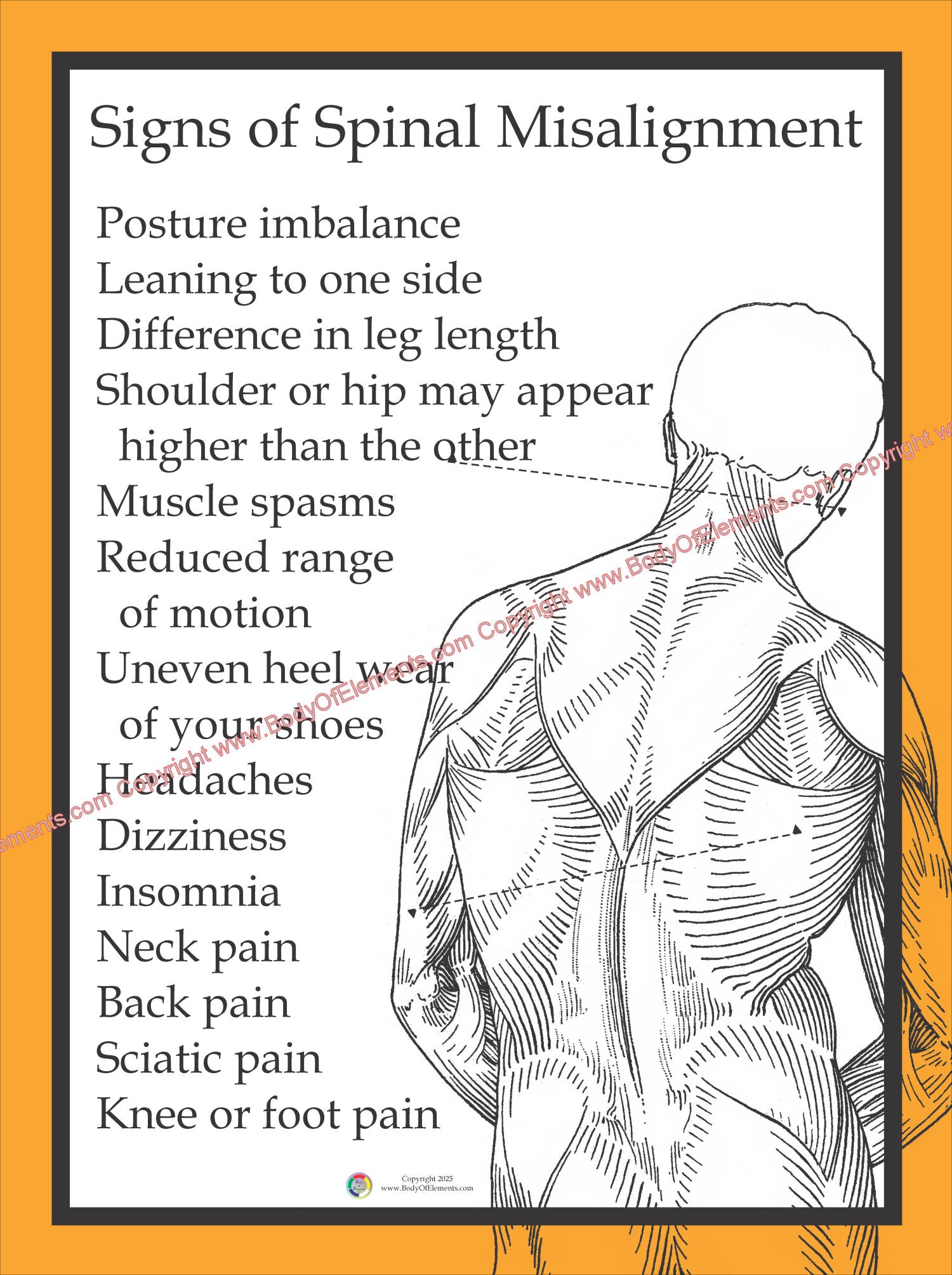 Signs and Symptoms of Spinal Misalignment Poster – Body of Elements