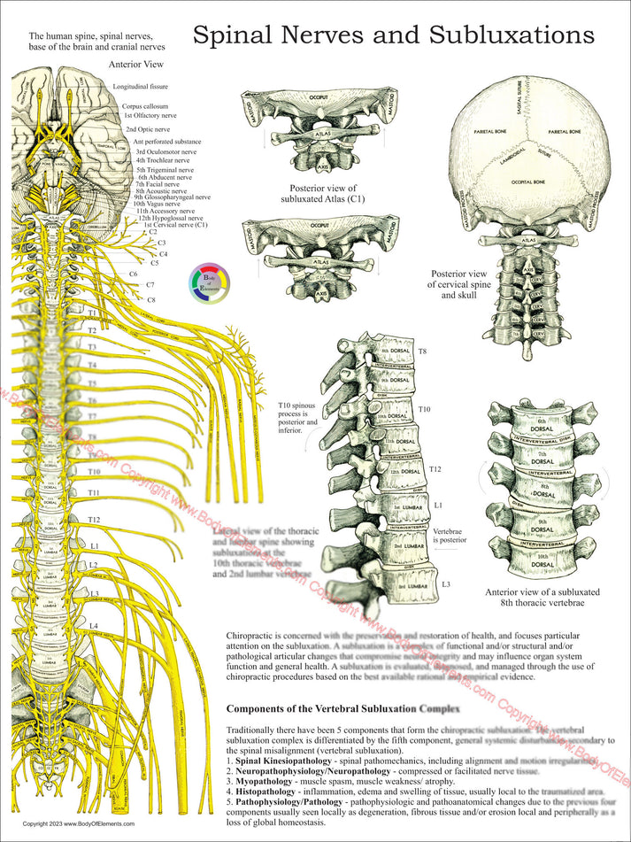 Chiropractic Subluxation Complex Poster – Body of Elements