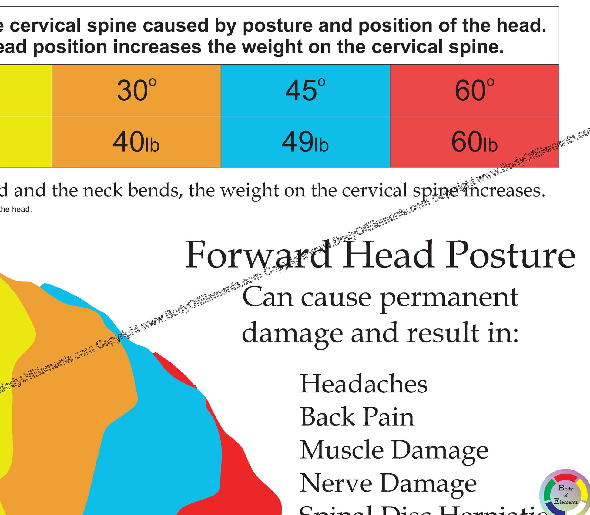 Forward Head Posture Pain Chart