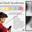 text neck syndrome pain poster.