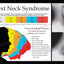 Text Neck Syndrome Chiropractic Poster