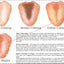Tongue diagnosis coating descriptions